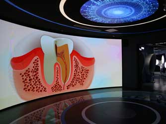  Arc curtain projection